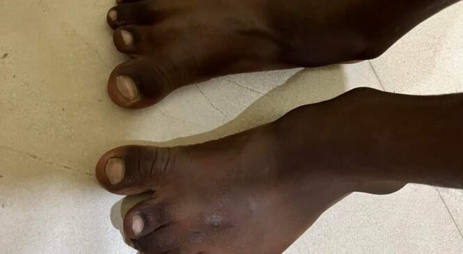 तीन दिने स्त्रीरोग विशेषज्ञ तथा अर्थोपेडिक स्वास्थ्य शिविर सम्पन्न